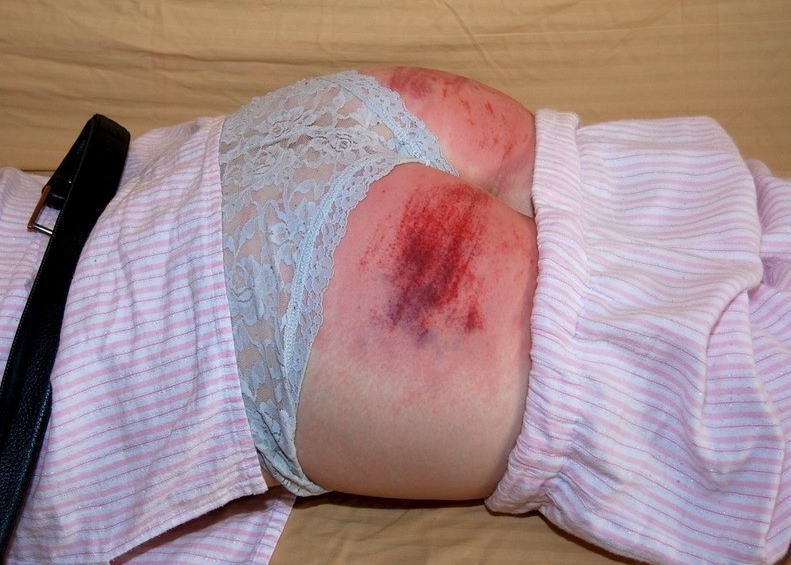 スパンキング ウィッピング お尻 叩く BDSM エロ画像