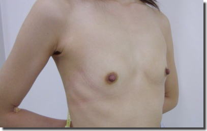 おっぱいにブラジャー跡やら圧迫痕が確認できるエロ画像 ①