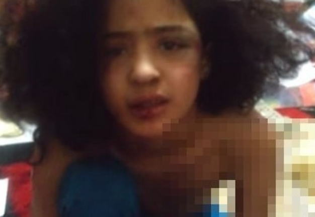 【閲覧注意】セ○クスした事がバレた10歳の女の子はこうなる・・・（画像）