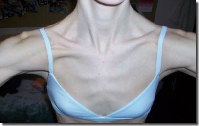 痩せの鎖骨フェチ！ガリガリ女性の骨身にしみるエロ画像 ④