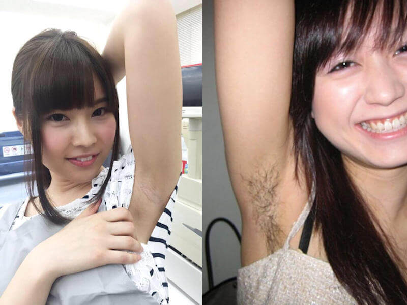 腋見せのエロ画像 （ツルワキとワキ毛） 