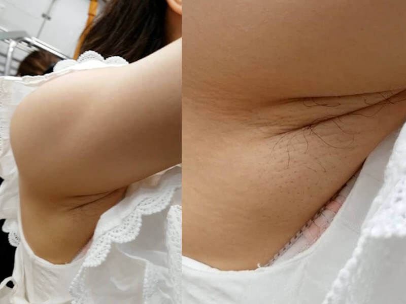 ワキの皺が鮮明なエロ画像 